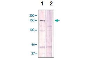 The cell lysate derived from Conditioned NIH/3T3 cell was immunoprecipitated by ROCK2 (phospho T396) polyclonal antibody , then immunoprobed by the same antibody at 1 : 500 (lane 1). (ROCK2 抗体  (pThr396))