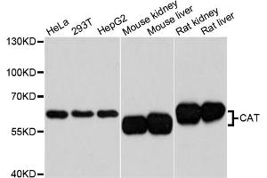 Western blot analysis of extracts of various cell lines, using CAT antibody. (Catalase 抗体)