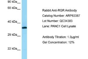 Western Blotting (WB) image for anti-Retinal G Protein Coupled Receptor (RGR) (N-Term) antibody (ABIN2774370) (RGR 抗体  (N-Term))