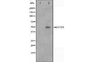 Western blot analysis on Jurkat cell lysate using ZIC1/2/3 Antibody,The lane on the left is treated with the antigen-specific peptide. (ZIC1/2/3 抗体)