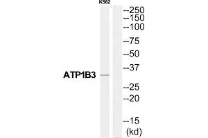 Western Blotting (WB) image for anti-ATPase, Na+/K+ Transporting, beta 3 Polypeptide (ATP1B3) (Internal Region) antibody (ABIN1852199) (ATP1B3 抗体  (Internal Region))