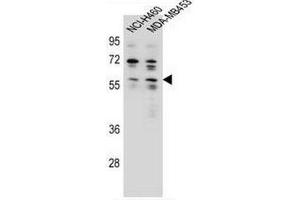 ANKRD34C Antibody (C-term) western blot analysis in NCI-H460,MDA-MB453 cell line lysates (35µg/lane). (ANKRD34C 抗体  (C-Term))