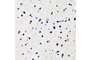 Immunohistochemistry of paraffin-embedded rat brain using CAMKIV Rabbit mAb (ABIN7266021) at dilution of 1:100 (40x lens). (CAMK4 抗体)