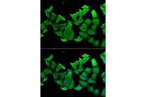 Immunofluorescence analysis of A549 cell using HAGH antibody. (HAGH 抗体)