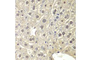 Immunohistochemistry of paraffin-embedded mouse liver using NR3C1 antibody at dilution of 1:200 (400x lens). (Glucocorticoid Receptor 抗体)