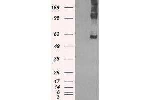 Image no. 2 for anti-Solute Carrier Family 7 (Amino Acid Transporter, L-Type), Member 8 (SLC7A8) antibody (ABIN1500964) (SLC7A8 抗体)