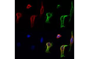 ABIN6258278 and ABIN6273860 staining Hela cells by IF/ICC. (GPR20 抗体  (C-Term))