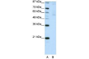 ZNF92 antibody (20R-1238) used at 0. (ZNF92 抗体  (C-Term))