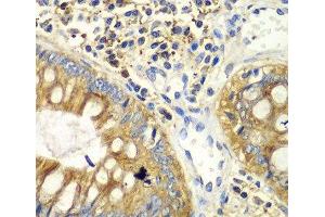 Immunohistochemistry of paraffin-embedded Human colon using PICK1 Polyclonal Antibody at dilution of 1:100 (40x lens). (PICK1 抗体)