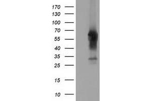 HEK293T cells were transfected with the pCMV6-ENTRY control (Left lane) or pCMV6-ENTRY CD5 (Right lane) cDNA for 48 hrs and lysed. (CD5 抗体)