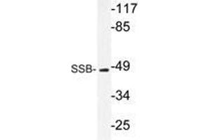 Western blot analysis of SSB antibody in extracts from 293 cells. (SSB 抗体)