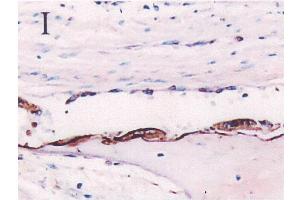 Immunohistochemistryimageof Osteopontin staining in paraffin section of fetal calvaria. (Osteopontin 抗体  (AA 59-74))
