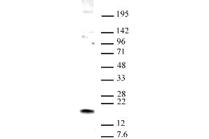HMGN1 antibody (pAb) tested by Western blot. (HMGN1 抗体  (C-Term))