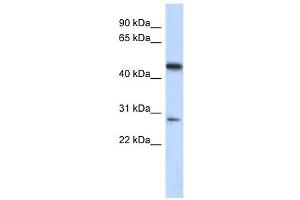 C13ORF31 antibody used at 1 ug/ml to detect target protein. (LACC1 抗体  (Middle Region))