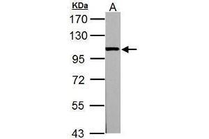 WB Image Sample (30 ug of whole cell lysate) A: PC-12 7. (ACTN3 抗体  (Center))