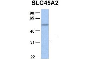 Western Blotting (WB) image for anti-Solute Carrier Family 45, Member 2 (SLC45A2) (C-Term) antibody (ABIN2781555)