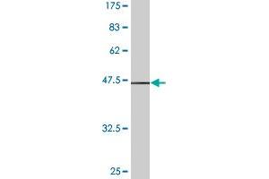 Western Blot detection against Immunogen (37. (Stathmin 1 抗体  (AA 40-149))