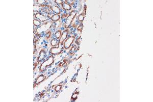 Immunohistochemistry of paraffin-embedded Mouse kidney using CHDH Rabbit pAb (ABIN7266341) at dilution of 1:100 (40x lens). (CHDH 抗体  (AA 245-594))