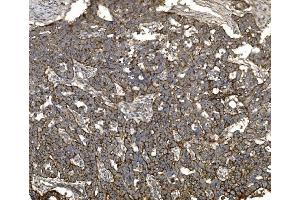 IHC analysis of Claudin 3/CLDN3 using anti-Claudin 3/CLDN3 antibody (ABIN7599626). (Claudin 3 抗体  (AA 101-220))