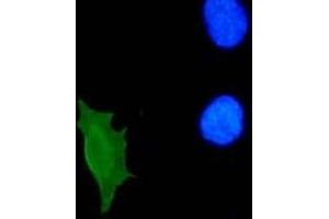 Immunofluorescence (IF) image for anti-Human Papilloma Virus 11 E7 (HPV-11 E7) (AA 36-70) antibody (ABIN781777) (人 Papilloma Virus 11 E7 (HPV-11 E7) (AA 36-70) 抗体)