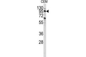 Western Blotting (WB) image for anti-Phosphoinositide-3-Kinase, Class 3 (PIK3C3) antibody (ABIN3000300) (PIK3C3 抗体)