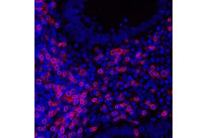 Immunofluorescence (IF) image for anti-CD3 epsilon (CD3E) (AA 157-207) antibody (ABIN7454035) (Recombinant CD3 epsilon 抗体  (AA 157-207))