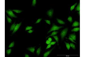 Immunofluorescence of purified MaxPab antibody to FES on HeLa cell. (FES 抗体  (AA 1-822))