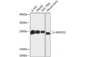 Western blot analysis of extracts of various cell lines using MESDC2 Polyclonal Antibody at dilution of 1:3000. (MESDC2 抗体)