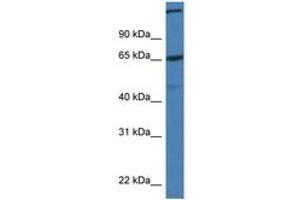 Image no. 1 for anti-ST6 (Alpha-N-Acetyl-Neuraminyl-2,3-beta-Galactosyl-1,3)-N-Acetylgalactosaminide alpha-2,6-Sialyltransferase 1 (ST6GALNAC1) (AA 450-499) antibody (ABIN6747275) (ST6GALNAC1 抗体  (AA 450-499))