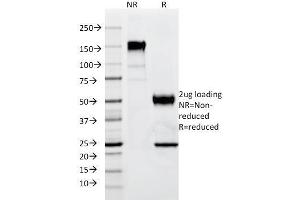 SDS-PAGE Analysis Purified p57 Mouse Monoclonal Antibody (SPM308). (CDKN1C 抗体)