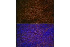 Immunohistochemistry (IHC) image for anti-S100 Calcium Binding Protein A12 (S100A12) (AA 1-92) antibody (ABIN6147336)