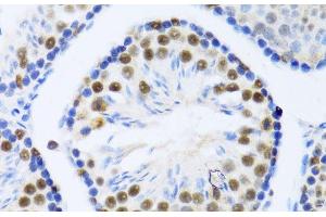 Immunohistochemistry of paraffin-embedded Mouse testis using DDX46 Polyclonal Antibody at dilution of 1:100 (40x lens). (DDX46 抗体)