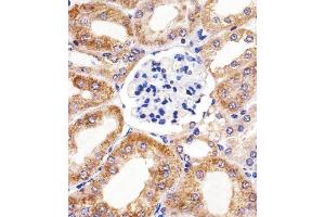 Immunohistochemical analysis of paraffin-embedded M. (BCL10 抗体  (AA 1-143))