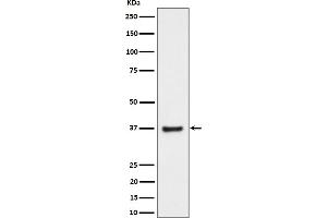 Western blot analysis of RNF115 expression in PC-3 cell lysate.