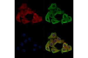 Phospho-LRP6 (Ser1420) Antibody staining Hela cells(heat shock treatment) by IF/ICC. (LRP6 抗体  (pSer1420))