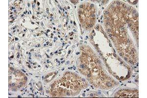 Immunohistochemical staining of paraffin-embedded Human Kidney tissue using anti-CAT mouse monoclonal antibody. (Catalase 抗体)