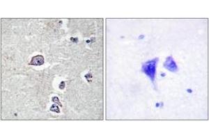Immunohistochemistry analysis of paraffin-embedded human brain tissue, using PDGFR alpha (Ab-754) Antibody. (PDGFRA 抗体  (AA 721-770))