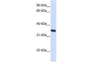 RTN1 antibody used at 1 ug/ml to detect target protein. (Reticulon 1 抗体  (N-Term))