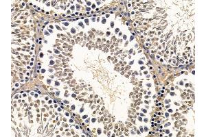 ABIN7093928 and ABIN7097972 at 1/100 staining rat testis tissue by IHC-P. (NHP2 抗体  (Internal Region))