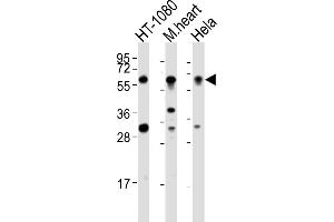 All lanes : Anti-SMYD2 Antibody (N-term) at 1:2000 dilution Lane 1: HT-1080 whole cell lysates Lane 2: mouse heart lysates Lane 3: Hela whole cell lysates Lysates/proteins at 20 μg per lane. (SMYD2A 抗体  (N-Term))