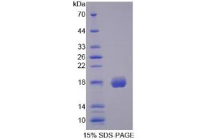 SDS-PAGE analysis of Human CFP Protein. (CFP 蛋白)