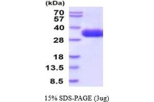 SDS-PAGE (SDS) image for Cytokine Receptor-Like Factor 2 (CRLF2) (AA 23-231) protein (His tag) (ABIN5854751)