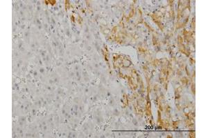 Image no. 1 for anti-CAMP Responsive Element Binding Protein 5 (CREB5) (AA 1-100) antibody (ABIN599087) (CREB5 抗体  (AA 1-100))