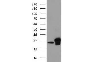 Western Blotting (WB) image for anti-Sjogren Syndrome/scleroderma Autoantigen 1 (SSSCA1) antibody (ABIN1501155) (SSSCA1 抗体)