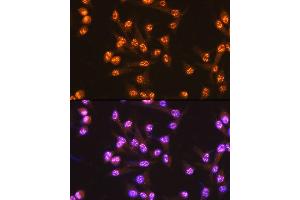 Immunofluorescence analysis of U-2 OS cells using PUMA Rabbit mAb (ABIN1678790, ABIN3018050, ABIN3018051 and ABIN7101572) at dilution of 1:100 (40x lens).