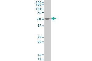 SSB polyclonal antibody (A01), Lot # FAK0060323QCS1 Western Blot analysis of SSB expression in HeLa . (SSB 抗体  (AA 1-408))