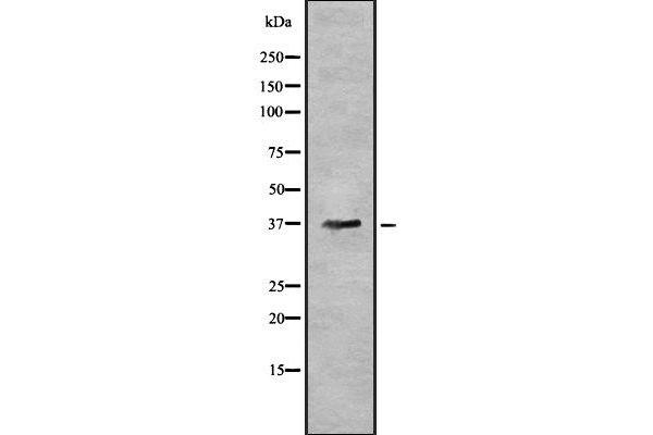 AWAT1 抗体  (Internal Region)