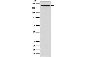 Western blot analysis of GCN2 expression in HeLa cell lysate.