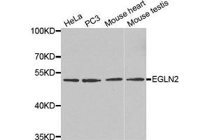 Western blot analysis of extracts of various cell lines, using EGLN2 antibody. (PHD1 抗体  (AA 150-250))