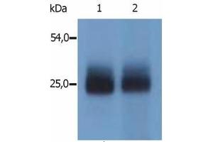 Image no. 1 for anti-Linker For Activation of T Cells Family, Member 2 (LAT2) (AA 124-203), (Cytoplasmic Domain), (N-Term) antibody (ABIN238344) (LAT2 抗体  (Cytoplasmic Domain, N-Term))